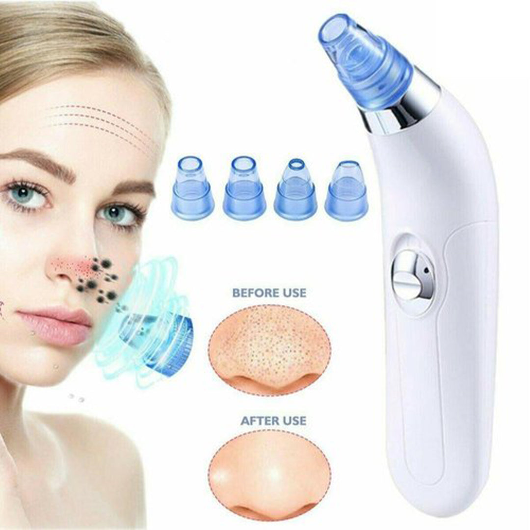 4 in 1 Blackheads Skin Vacuum Suction to Cleanse Pores, Clean Acne, Pimples and Blackhead