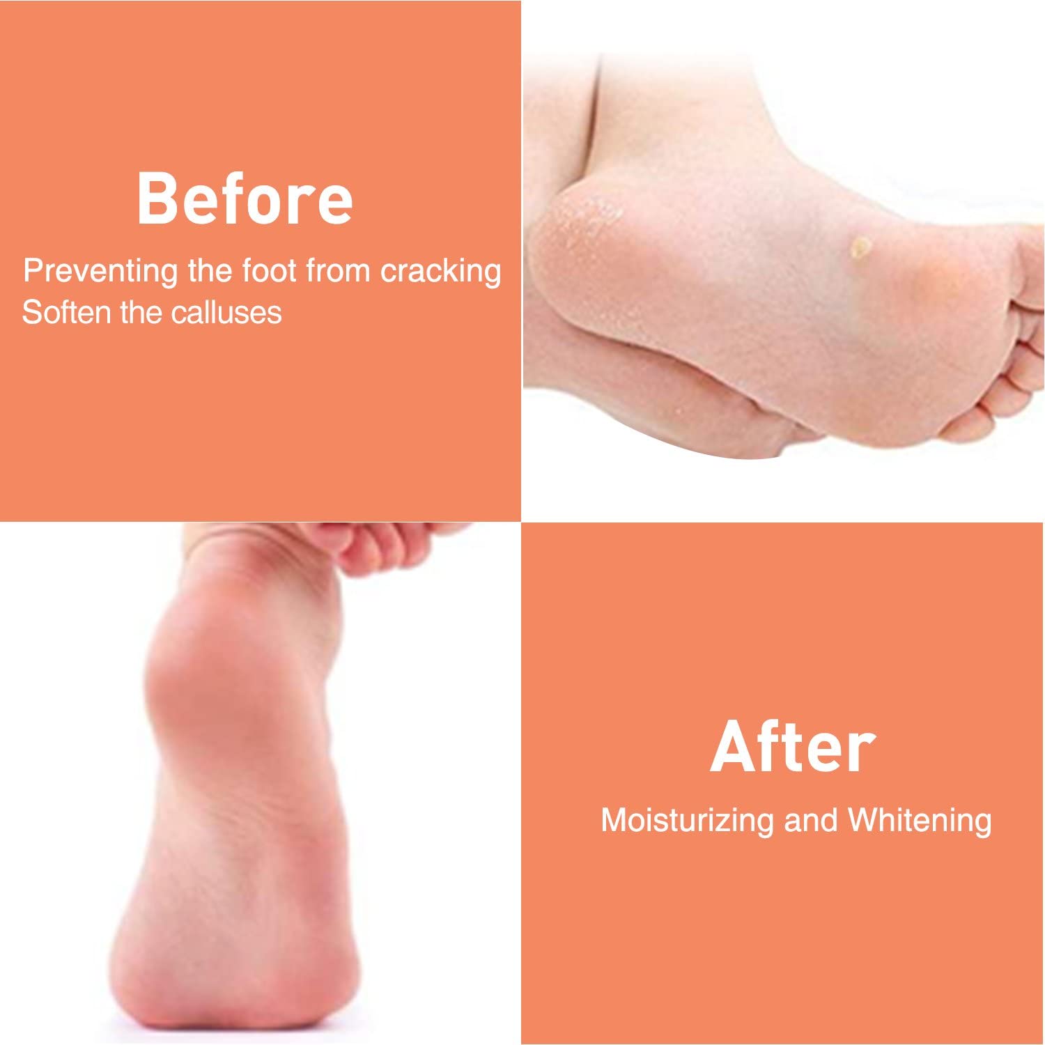 HEEL PROTECTOR For DRY HEEL | CRACKED HEEL | ROUGH HEEL | ANKLE PAIN | HEEL PAIN | HEEL ANTI CRACK - FOR MEN AND WOMEN - 3 Pairs