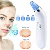 4 in 1 Blackheads Skin Vacuum Suction to Cleanse Pores, Clean Acne, Pimples and Blackhead